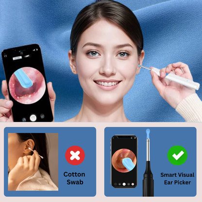 MAG+ Smart Visual Ear Picker