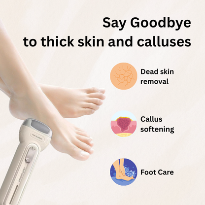 MAG+ Electric Foot Callus Remover