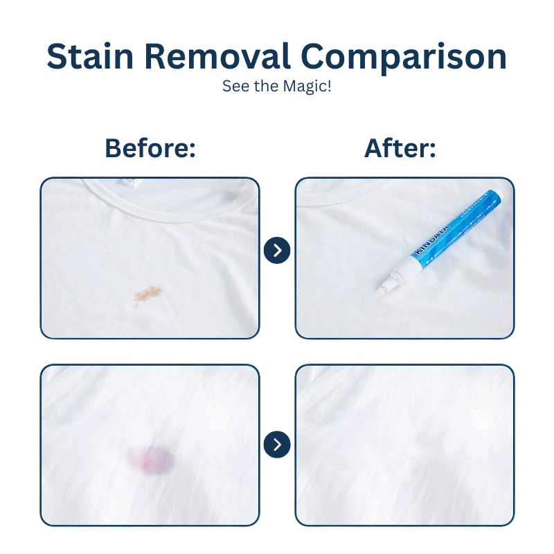 MAG+ Stain Remover Pen