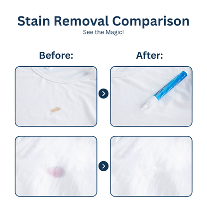 MAG+ Stain Remover Pen