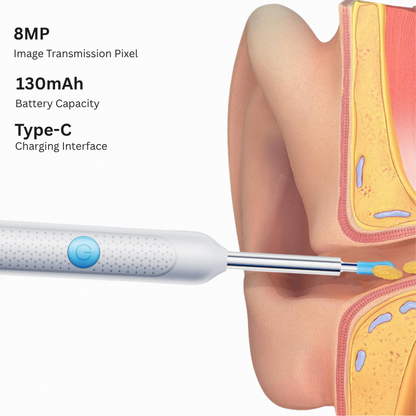 MAG+ Smart Visual Ear Picker